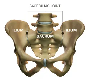 Can Chiropractic Help my SI Joint pain