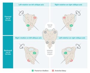 Can Chiropractic Help my SI Joint pain?