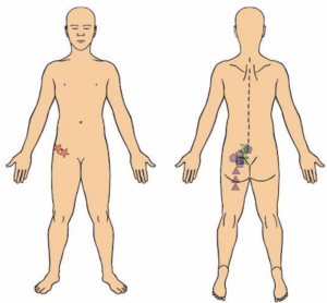 SI Joint Pain During Pregnancy